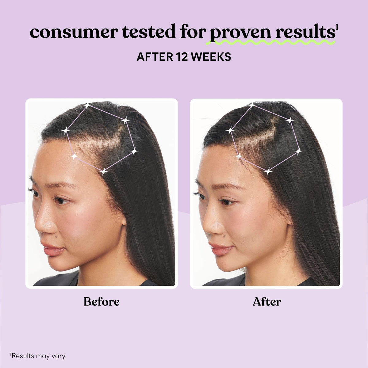 Hair Growth Capsules 30-Day Supply U691
