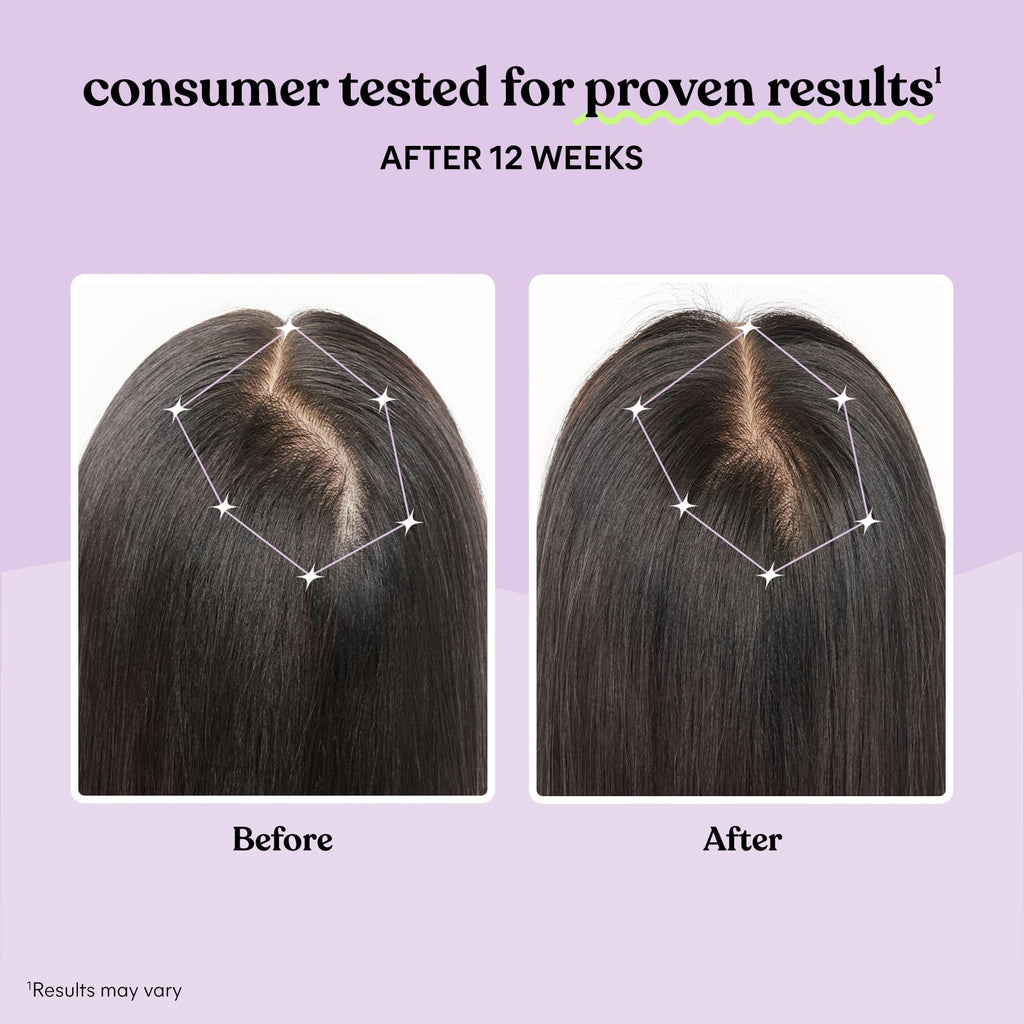Hair Growth Capsules 30-Day Supply U691